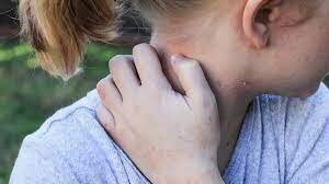 ۷ نشانه‌ی پوستی که خبر از بیماری جدی می‌دهند