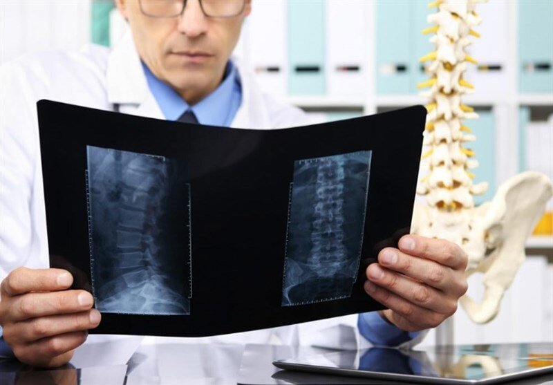 ۵ روش عالی برای داشتن استخوانهای محکم و سالم ۵ روش عالی برای داشتن استخوانهای محکم و سالم