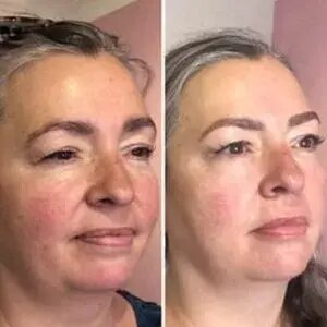 چگونه بدون جراحی جوان و زیباتر بهنظر برسیم؟ چگونه بدون جراحی جوان و زیباتر بهنظر برسیم؟