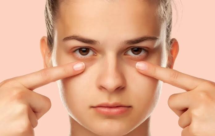 راز چشم‌های شاداب؛ چند راهکار فوری برای رفع پف زیر چشم
