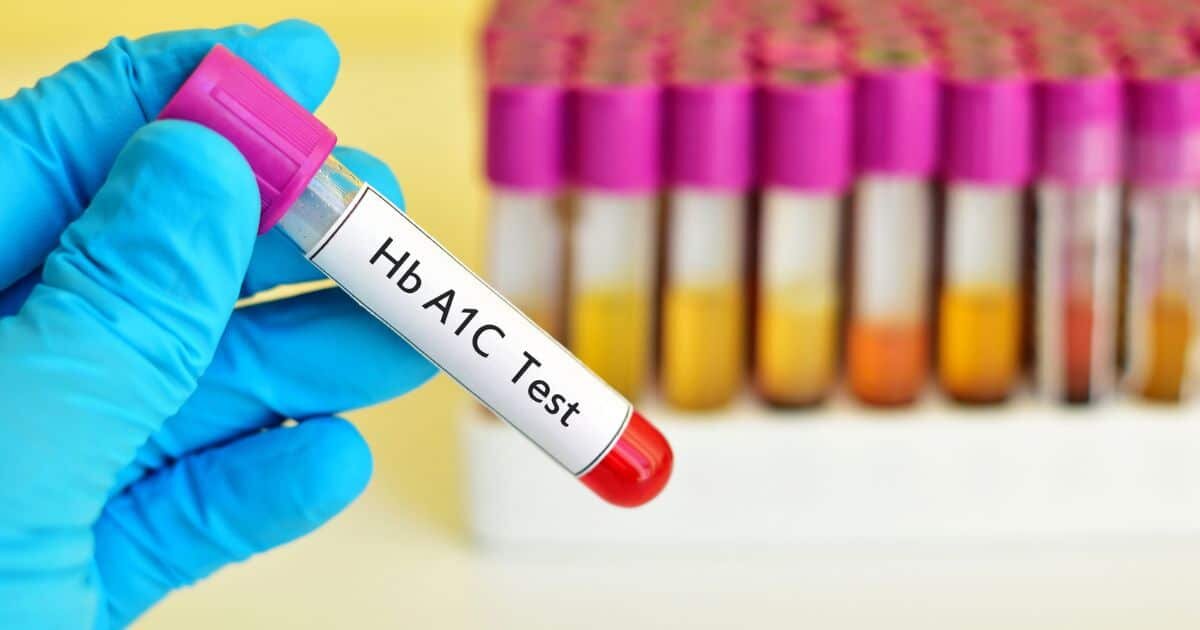 این عدد مهم در آزمایش خون، قند ۳ ماه گذشته‌تان را لو می‌دهد | HbA1c چیست و چرا بالا می‌رود؟
