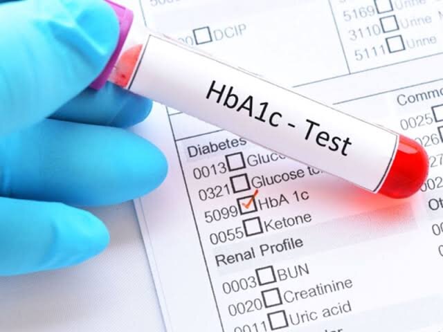 این عدد مهم در آزمایش خون، قند ۳ ماه گذشته‌تان را لو می‌دهد | HbA1c چیست و چرا بالا می‌رود؟