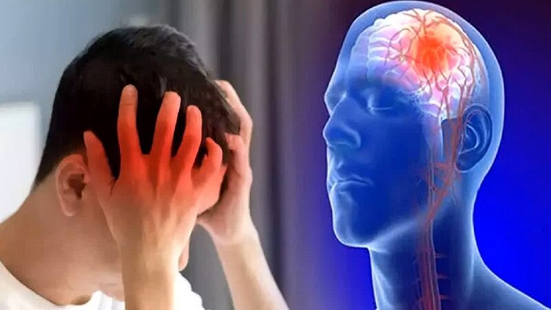 این علائم سکته مغزی را با بیماریهای دیگر اشتباه نگیرید؛ زمان مهم است این علائم سکته مغزی را با بیماریهای دیگر اشتباه نگیرید؛ زمان مهم است